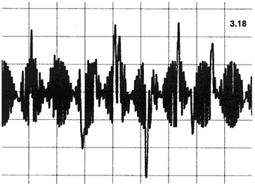 14/15-kHz-Doppeltonsignal